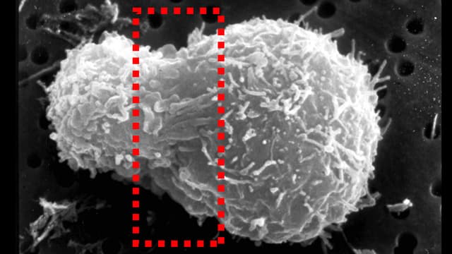 Rasteraufnahme vom Kampf des Immunsystems gegen eine Krebszelle Rasteraufnahme vom Kampf des Immunsystems gegen eine Krebszelle