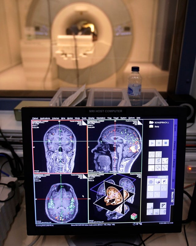 Ein Magnetresonanz-Tomograph wie hier in der Universität Genf zeigt Forschern, welche Hirnregionen aktiv sind. Ein Magnetresonanz-Tomograph wie hier in der Universität Genf zeigt Forschern, welche Hirnregionen aktiv sind.
