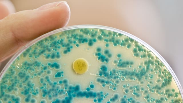 Eine Labormitarbeiterin weist auf einer Indikatorkulturplatte resistenten Bakterien nach. Eine Labormitarbeiterin weist auf einer Indikatorkulturplatte resistenten Bakterien nach.