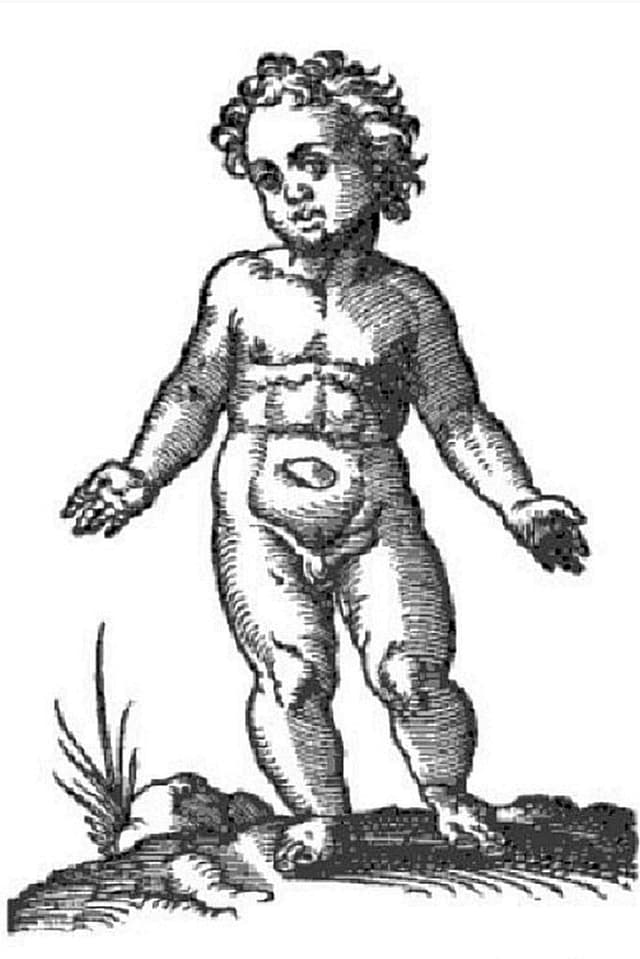 Hermaphrodit Hermaphrodit