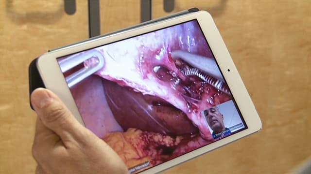 Ein Tablet-PC übermittelt Bilder während einer Operation an einen anderen Kollegen. Ein Tablet-PC übermittelt Bilder während einer Operation an einen anderen Kollegen.