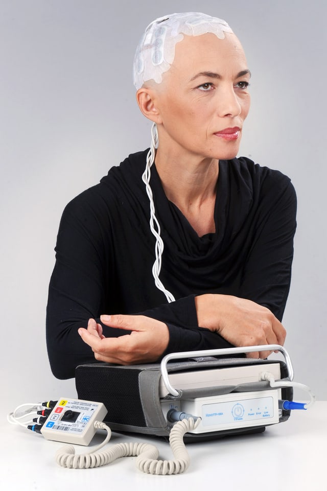 Beispielpatientin mit NovoTTF-100A und Elektroden am kahlgeschorenen Kopf. Beispielpatientin mit NovoTTF-100A und Elektroden am kahlgeschorenen Kopf.