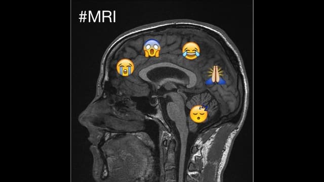 Radio SRF 1, 18.11.2015: Tweets aus dem MRI