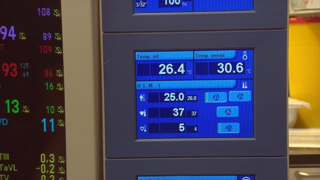 Monitor, der die Körpertemperatur der Patientin anzeigt. Monitor, der die Körpertemperatur der Patientin anzeigt.