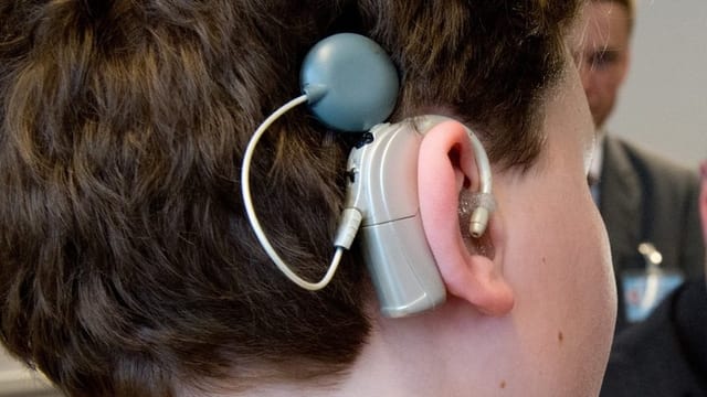 Ein Cochlea-Implantat. Ein Cochlea-Implantat.