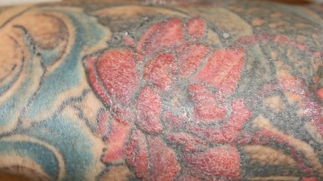 Schuppige Haut bei einem Tattoo. Schuppige Haut bei einem Tattoo.
