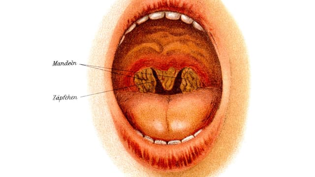 Grafik des Mund- und Rachenraums.