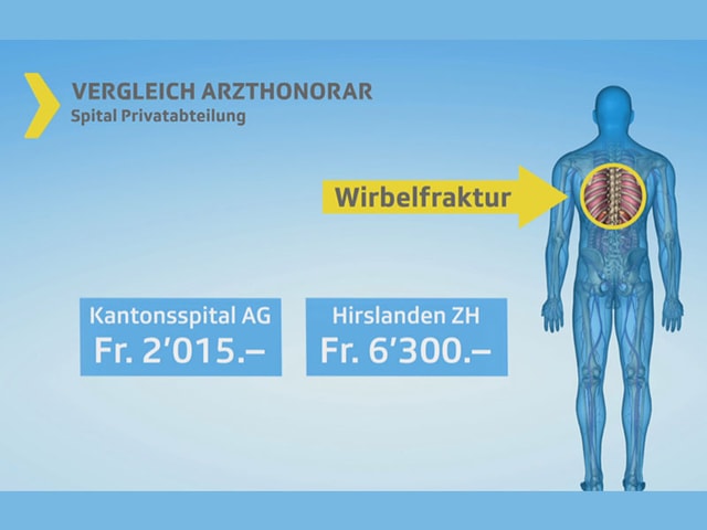 Grafik Preisvergleich Kantonsspital Hirslanden.