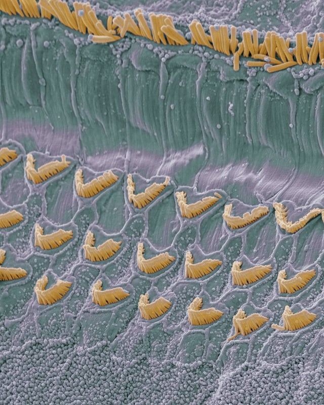 Makroskopische Darstellung der Haarsinneszellen im Innenohr. Makroskopische Darstellung der Haarsinneszellen im Innenohr.