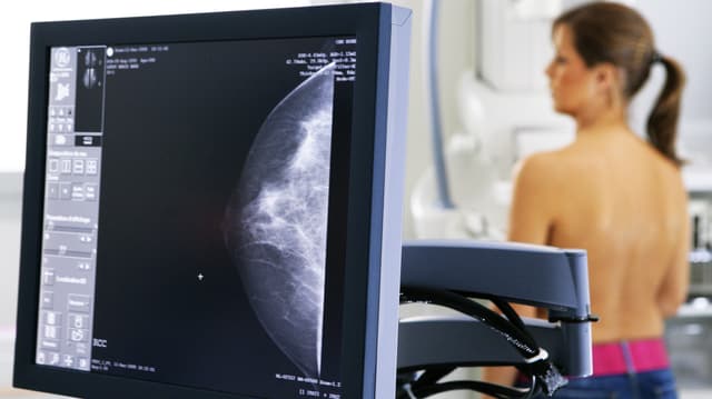 Ein Bildschrim mit der Mammografieaufnahme einer weiblichen Brust. Im Hintergrund steht verschwommen die Patientin am Mammografiegerät. Ein Bildschrim mit der Mammografieaufnahme einer weiblichen Brust. Im Hintergrund steht verschwommen die Patientin am Mammografiegerät.