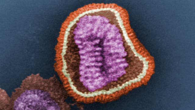 Ein Bild des H1N1-Virus. Ein Bild des H1N1-Virus.
