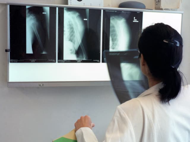 Eine Ärztin kontrolliert Röntgenbilder.