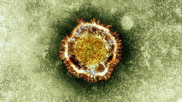 Mikroskop-Aufnahme eines Coronavirus. Mikroskop-Aufnahme eines Coronavirus.