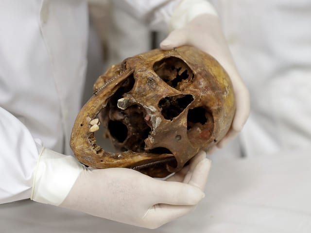 Der Schädel von Mengele Der Schädel von Mengele