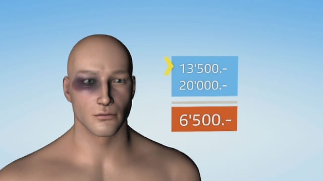 Grafik mit Mann mit blauem Auge. Grafik mit Mann mit blauem Auge.