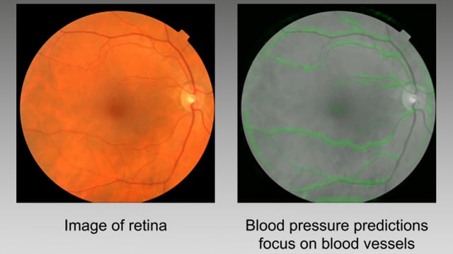 Zwei Bilder der Menschlichen Retina. Zwei Bilder der Menschlichen Retina.