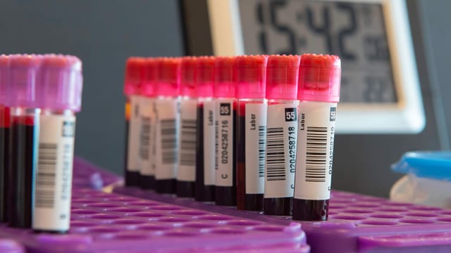 Teströhrchen mit Blut. Teströhrchen mit Blut.