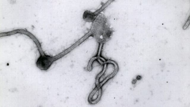 Aufnahme eines Virus'. Aufnahme eines Virus'.