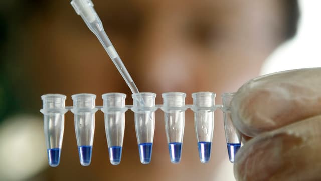 Eine Person füllt kleine Gefässe mit einer Pipette. Eine Person füllt kleine Gefässe mit einer Pipette.