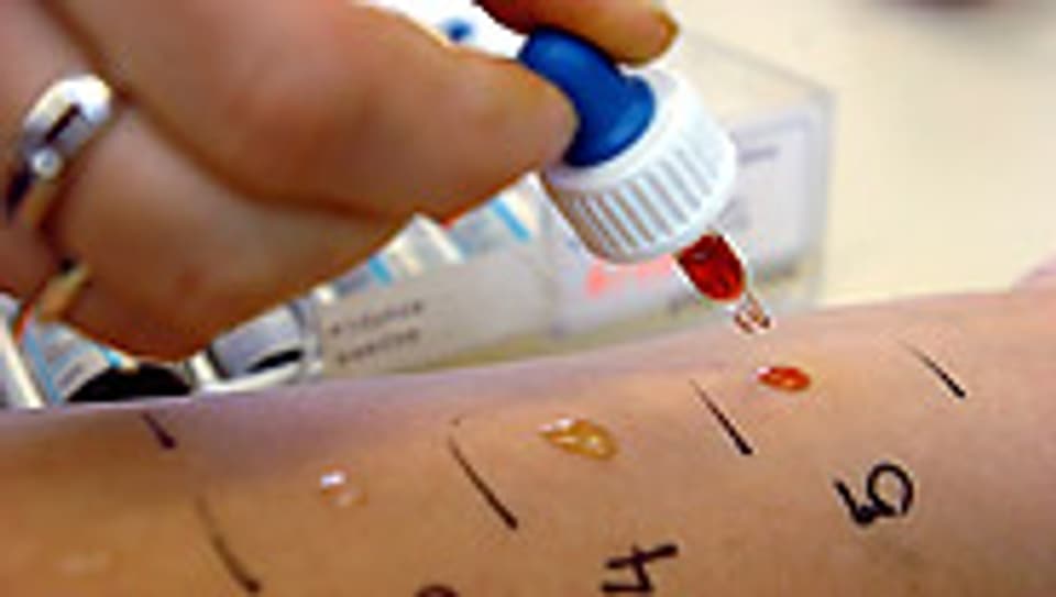 Mit einem Hauttest kann festgestellt werden, welche Stoffe die Beschwerden auslösen.