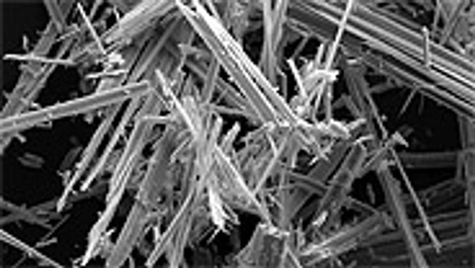 Können Krebs verursachen: Asbestfasern