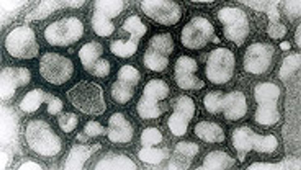 Aviäres Influenzavirus (HPAIV), elektronenmikroskopische Aufnahme