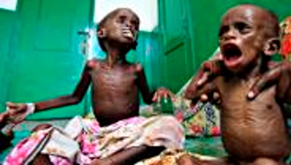 Unterernährte Kinder in einem Spital in Mogadischu.