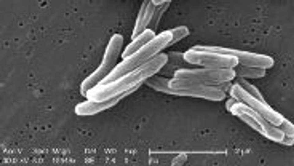 Tuberkulose wird durch Stäbchen-Bakterien verursacht.