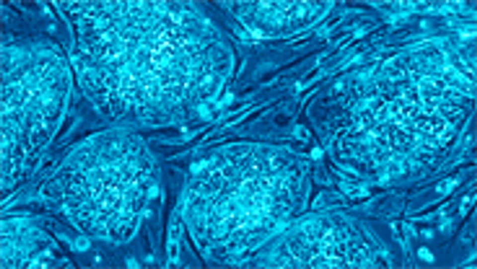 Undifferenzierte Zellkolonien von menschlichen, embryonalen Stammzellen.