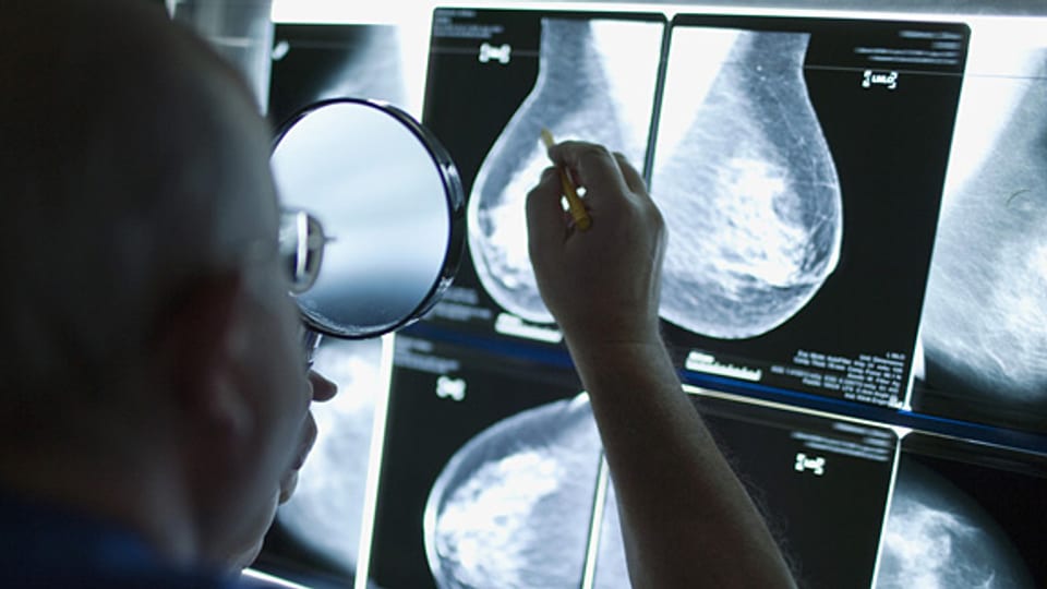 Ein Radiologe begutachtet das Röntgenbild einer Frau, Klinik Engeried in Bern.