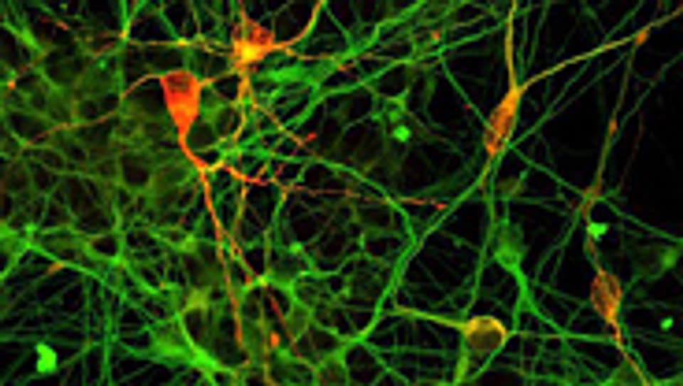 Neuronen, die aus iPS-Zellen (induzierte pluripotente Stammzellen) gezüchtet wurden - ein Verdienst von John Gurdon und Shinya Yamanaka.