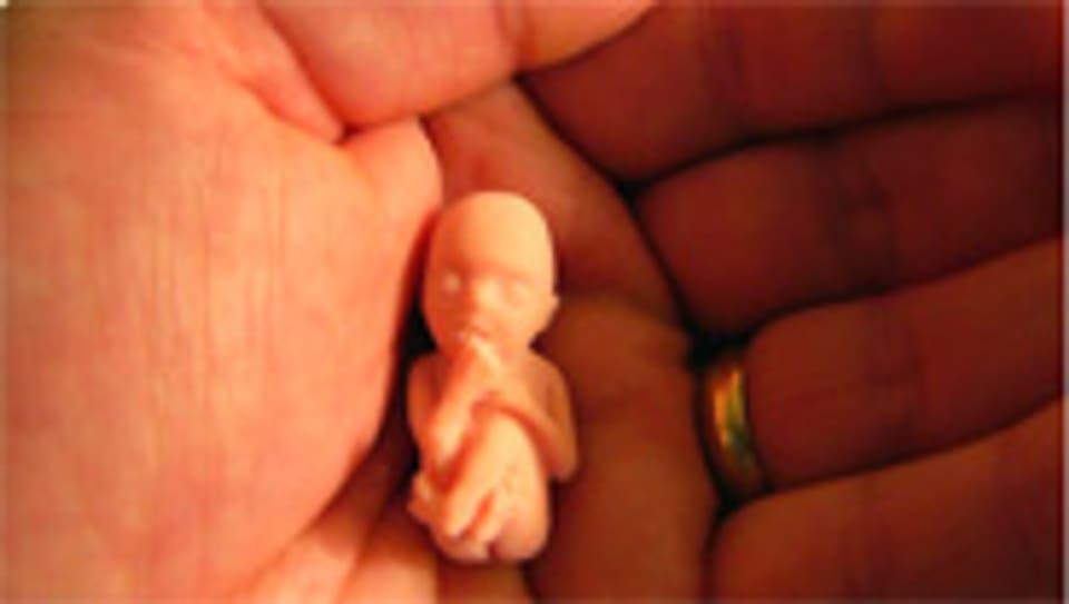 Das Modell eines neun Wochen alten Embryos.