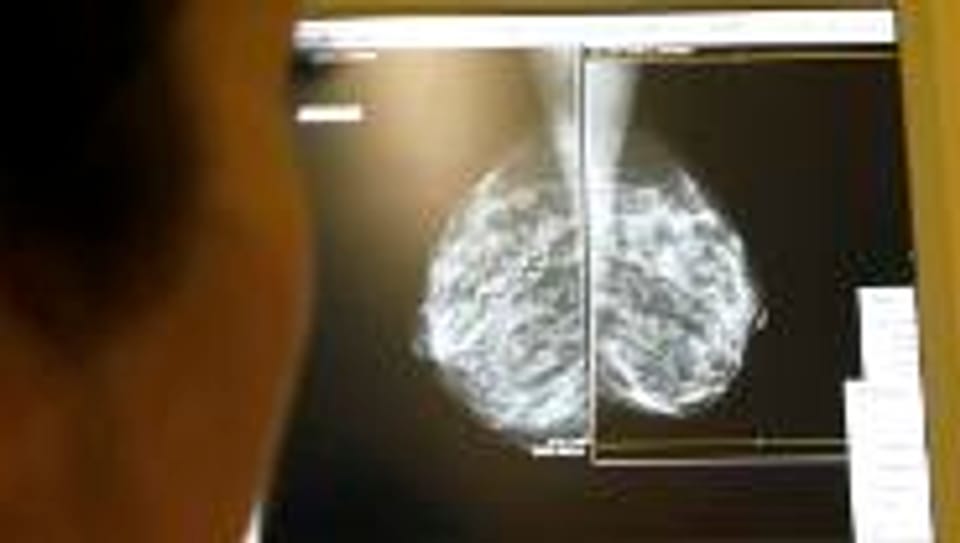 Eine Ärztin untersucht das Röntgenbild einer Brustaufnahme.