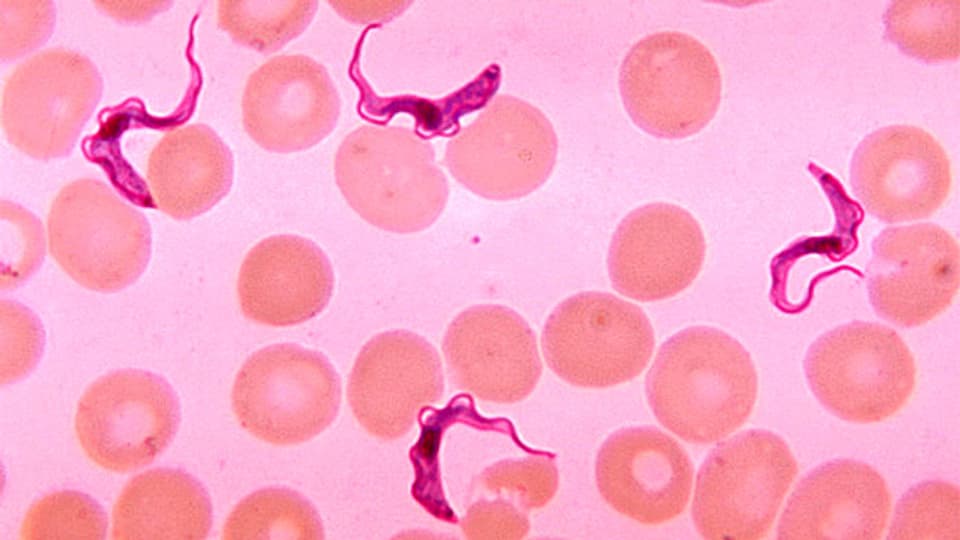 Trypanosomen im Blutausstrich eines Patienten mit afrikanischer Trypanosomiasis (Schlafkrankheit).