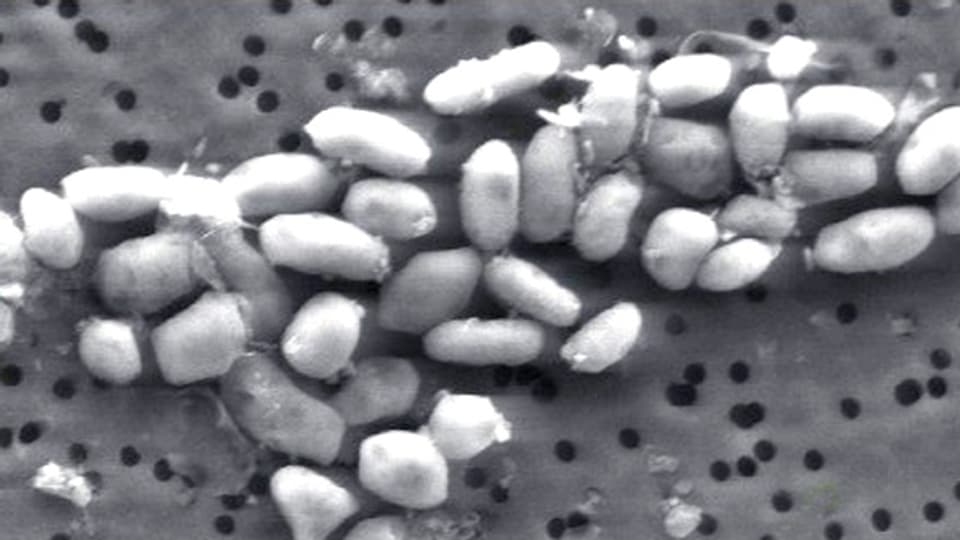 GFAJ-1 Bakterien auf einem arsenathaltigem Medium.