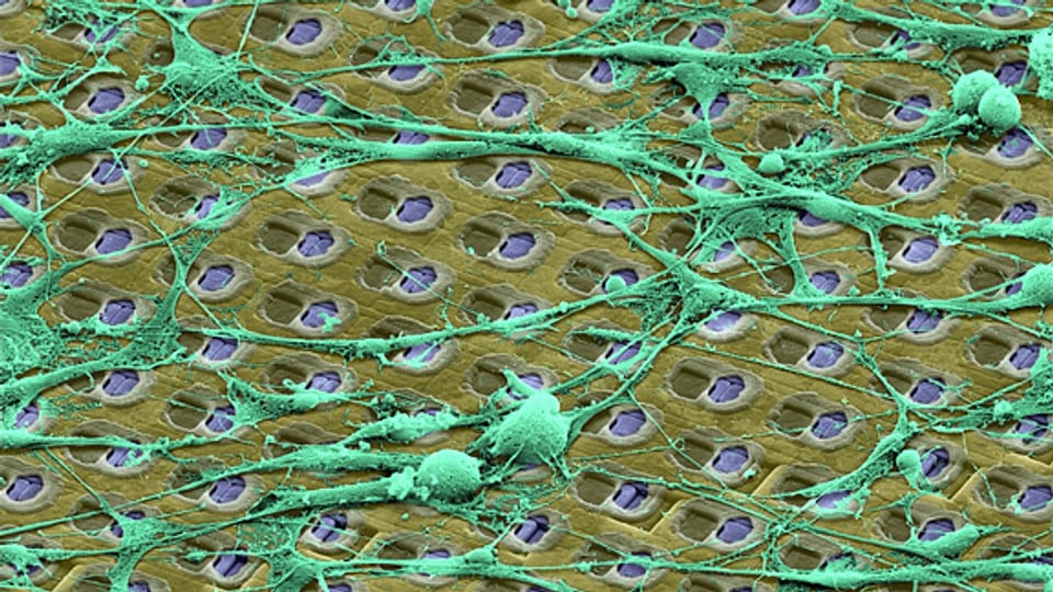 Das Netzwerk der Nervenzellen auf einem Chip.