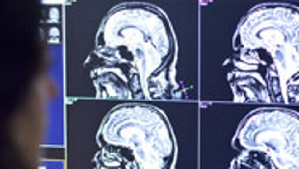 Durch die MRT werden die neuronalen Vorgänge im Gehirn sichtbar gemacht.