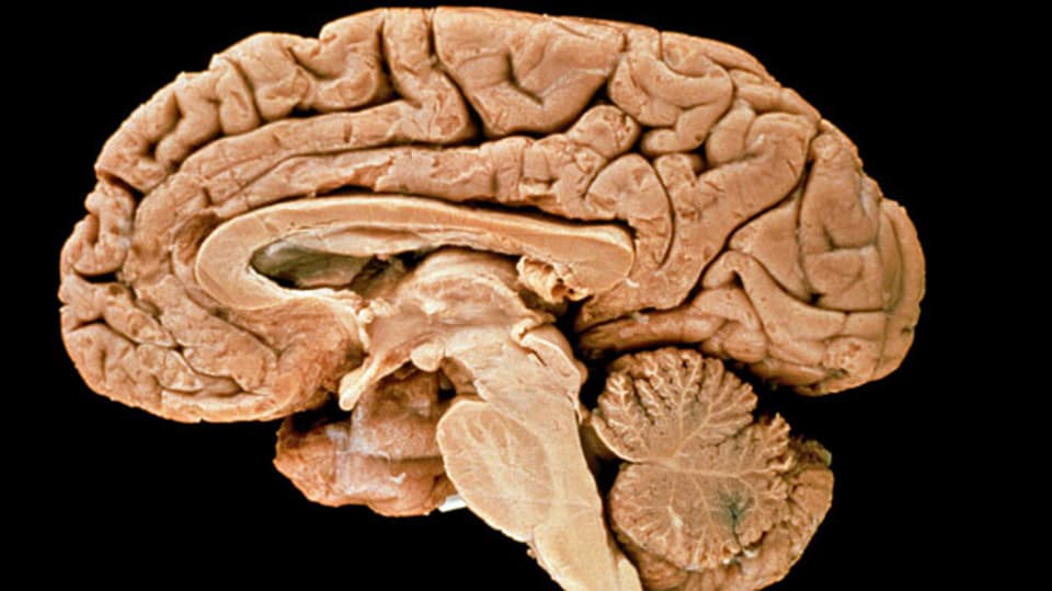 Seitenansicht eines menschlichen Gehirns.