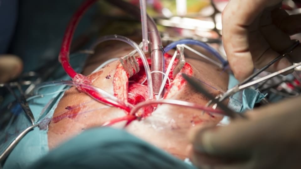 Verärgerte Aargauer Regierung wegen Herz-Operationen am Kantonsspital Aarau