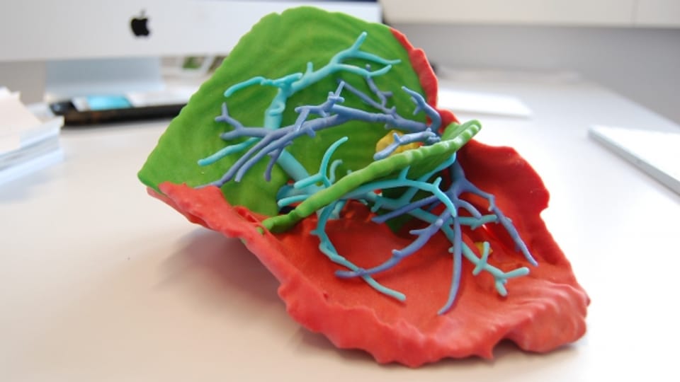 Das Modell einer Leber aus dem 3D-Drucker