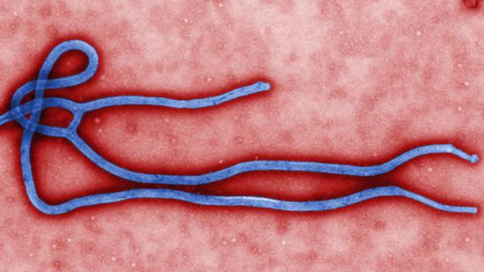 Das Ebola-Virus in Grossaufnahme.
