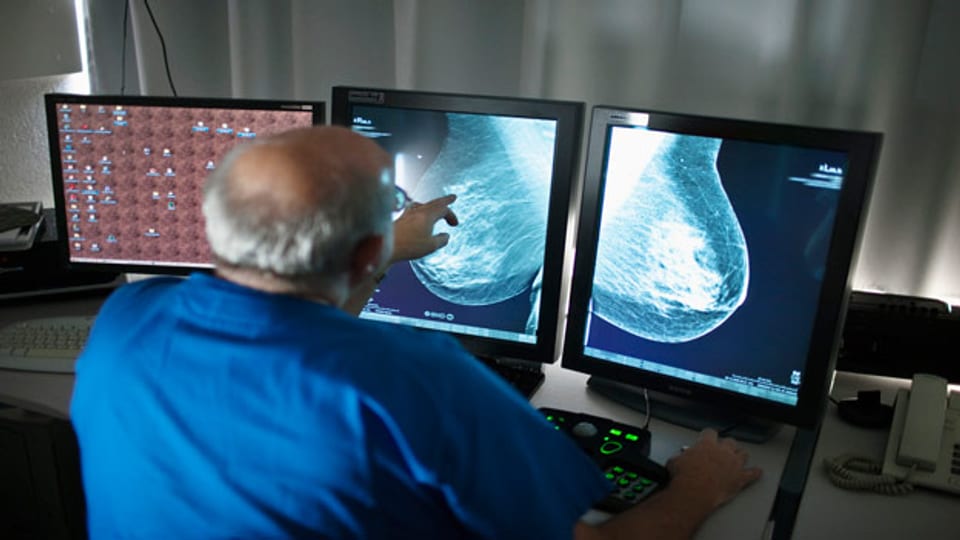 Mammografie-Programme für Frauen werden kritisiert