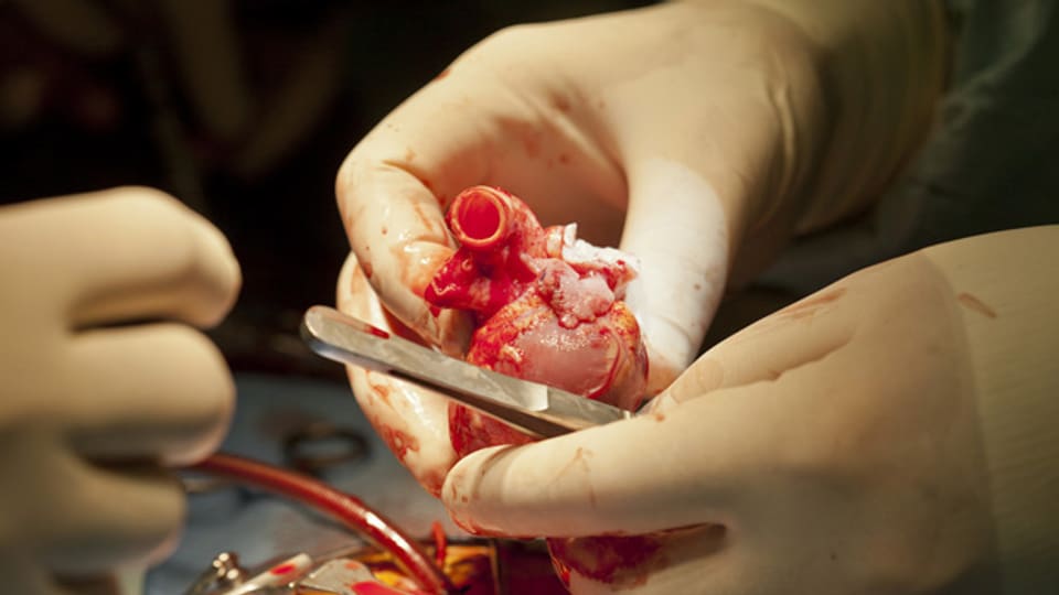 Herztransplantationen sind selten - doch die Qualität der Behandlungen ist gut, so das Fachgremium der GDK.