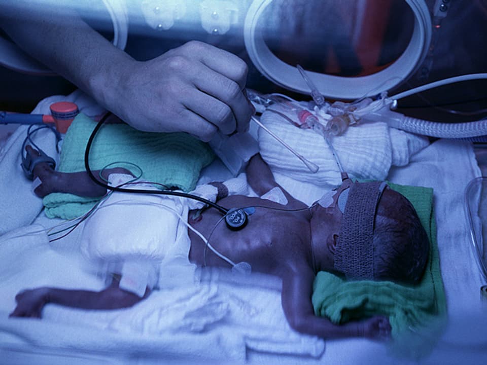 Ein frühgeborenes Kind in der Klinik