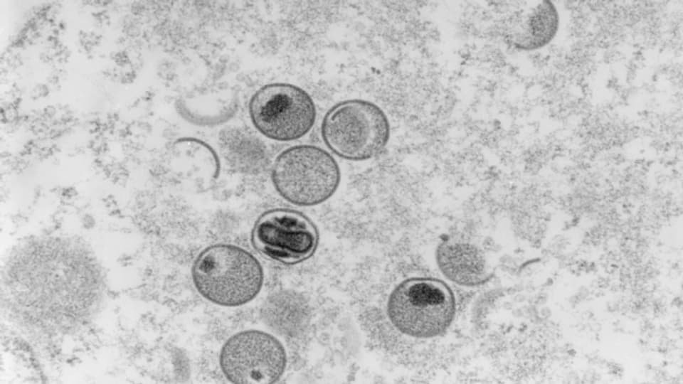 Das Bild zeigt eine elektronenmikroskopische Aufnahme von Affenpocken-Viren.