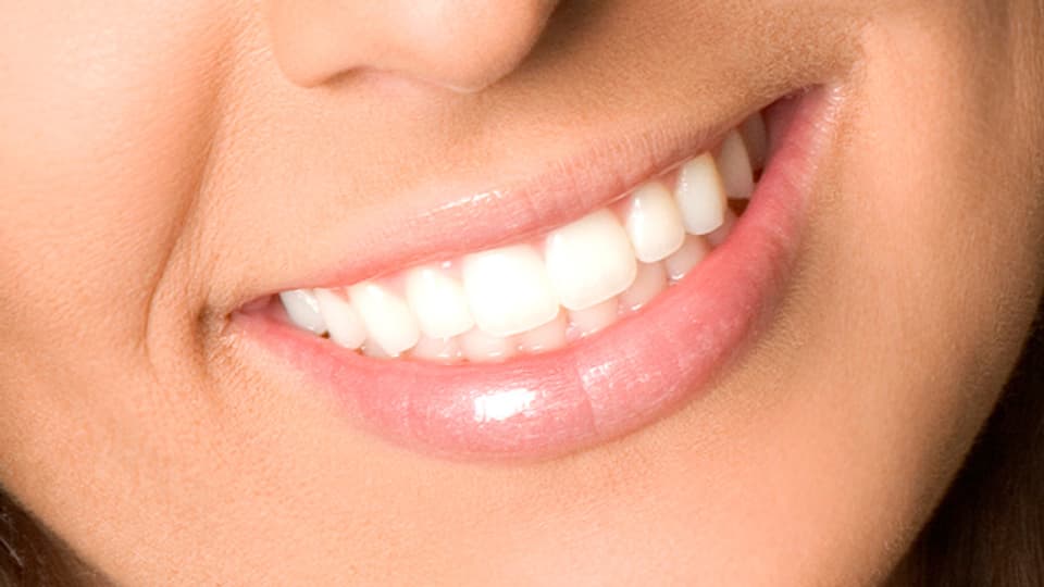 Die Zähne lassen sich mit verschiedenen Methoden aufhellen.