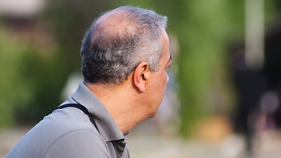 Männer leiden etwas häufiger unter Haarausfall als Frauen.