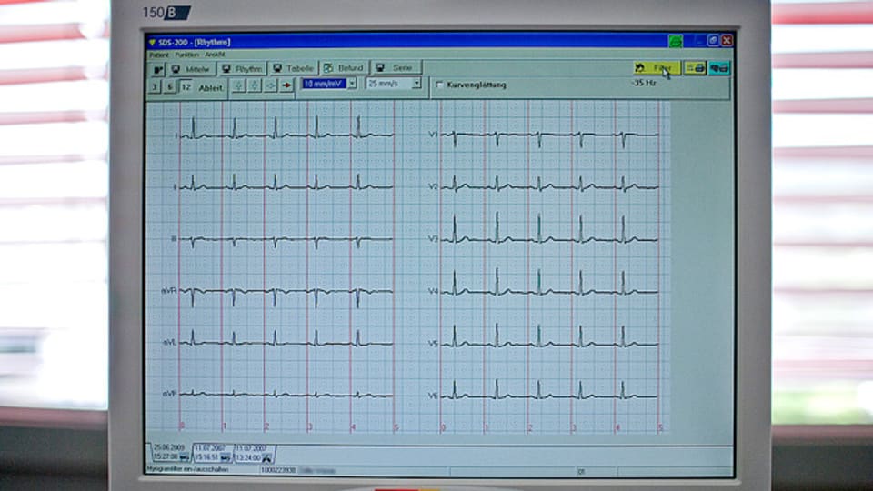 Lebenswichtig: Das EKG verrät viel über das Herz eines Patienten.