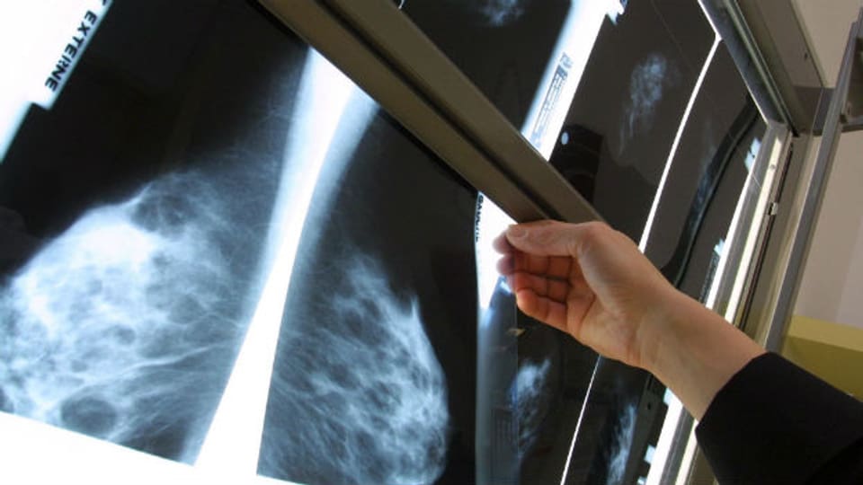 Wie häufig und ab welchem Alter soll eine Mammographie, also ein spezielles Röntgenbild der Brust, gemacht werden?