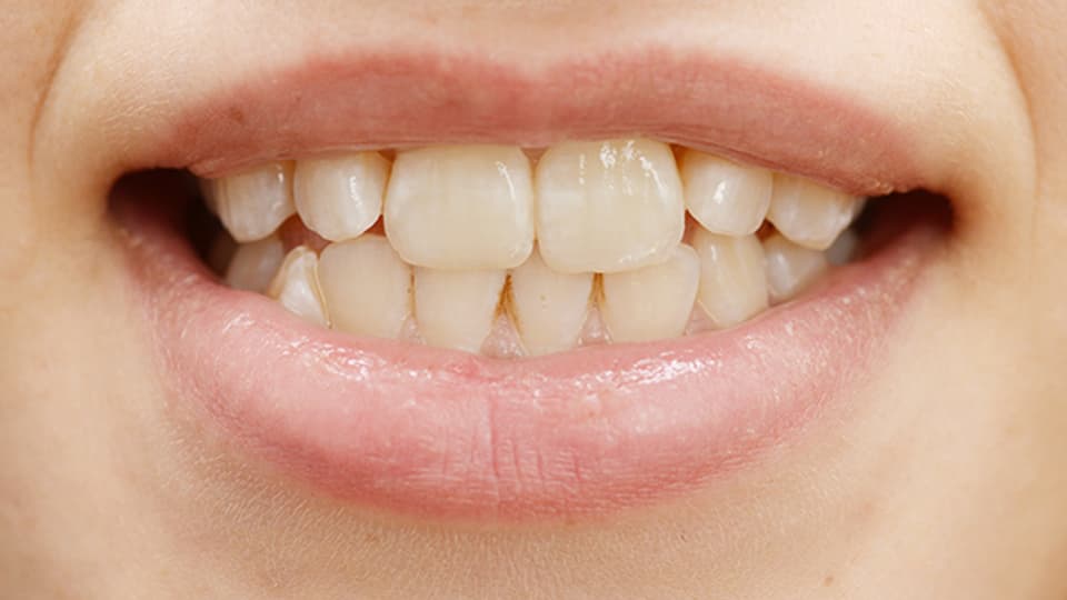 Milchprodukte und Rohkost wirken sich positiv auf die Zähne aus.